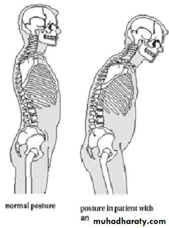 Seronegative Arthritis