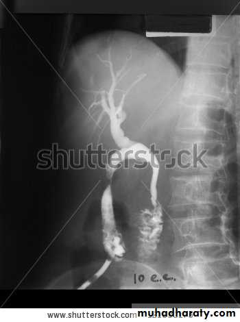 Liver and Biliary Diseases