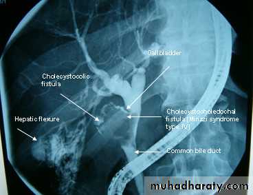 Liver and Biliary Diseases