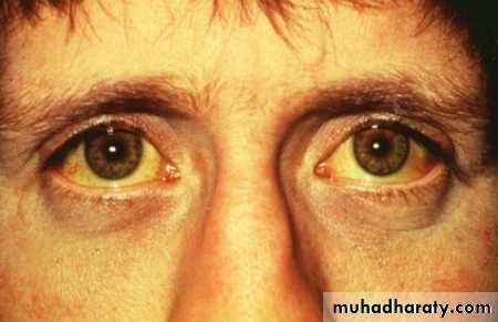 Liver and Biliary Diseases