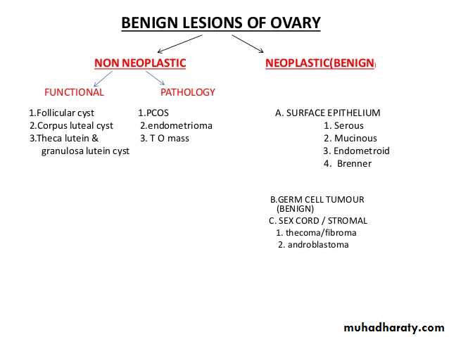 Benign Ovarian Tumour