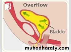 Urinary Incontinence