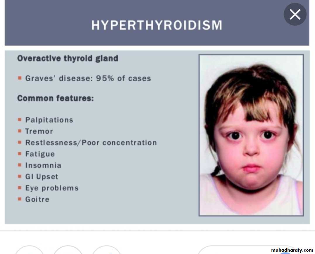 Thyroid Gland