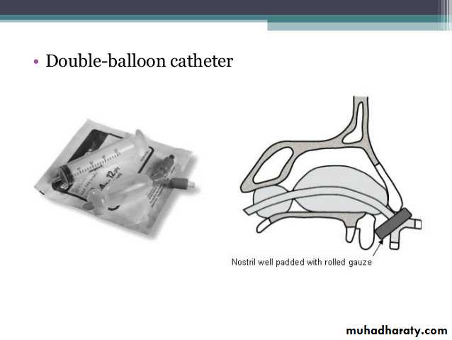 Epistaxis