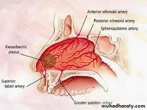 Epistaxis