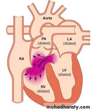 CHD