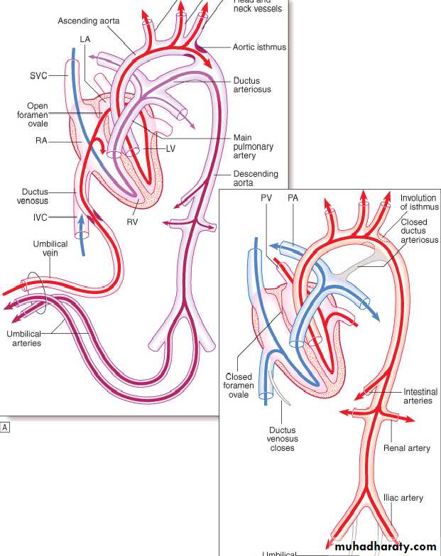 CHD