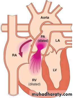 CHD