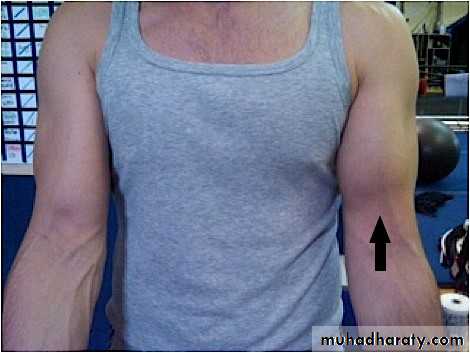 Shoulder disorders
