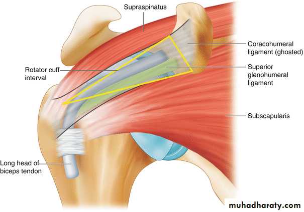 Shoulder disorders
