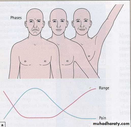 Shoulder disorders