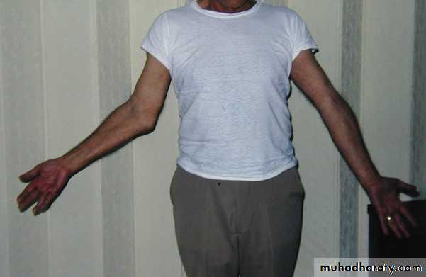 Elbow disorders