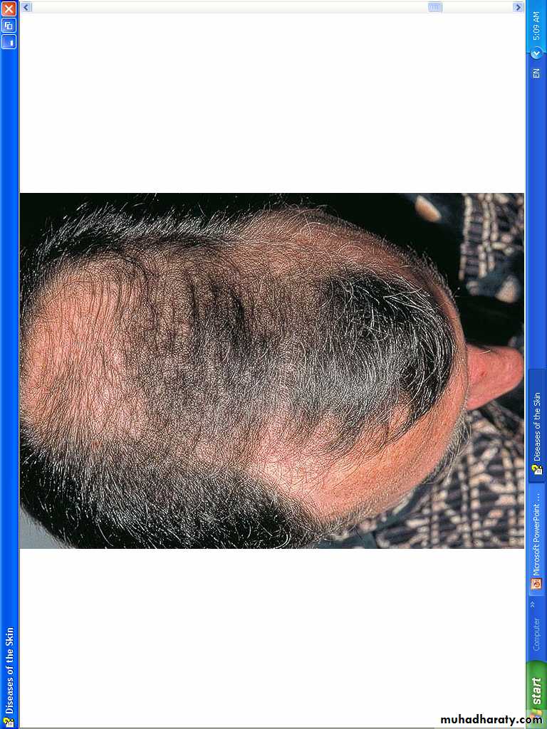 Hair Problems. Part 2