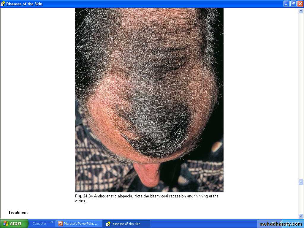 Hair Problems. Part 2