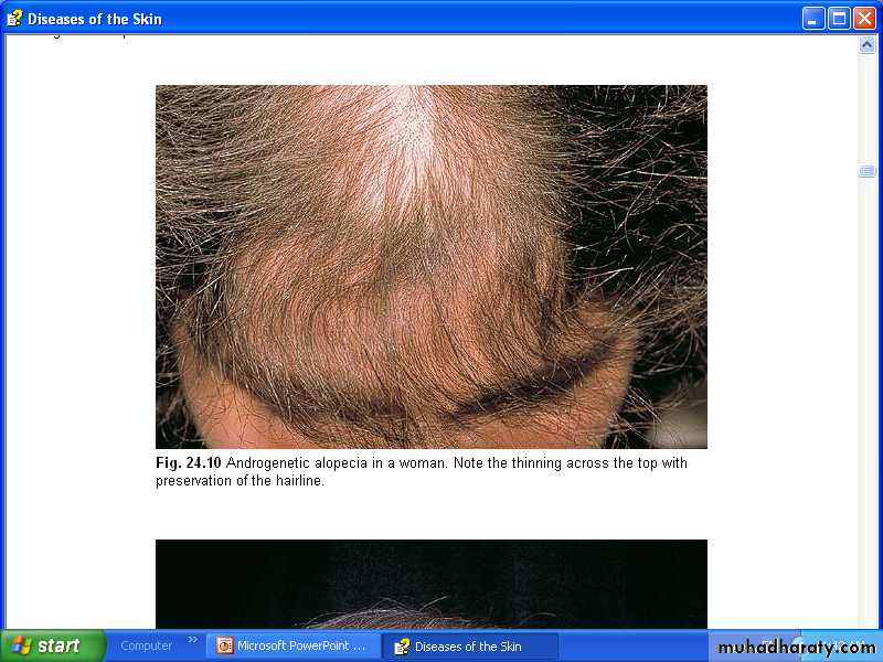 Hair Problems. Part 2