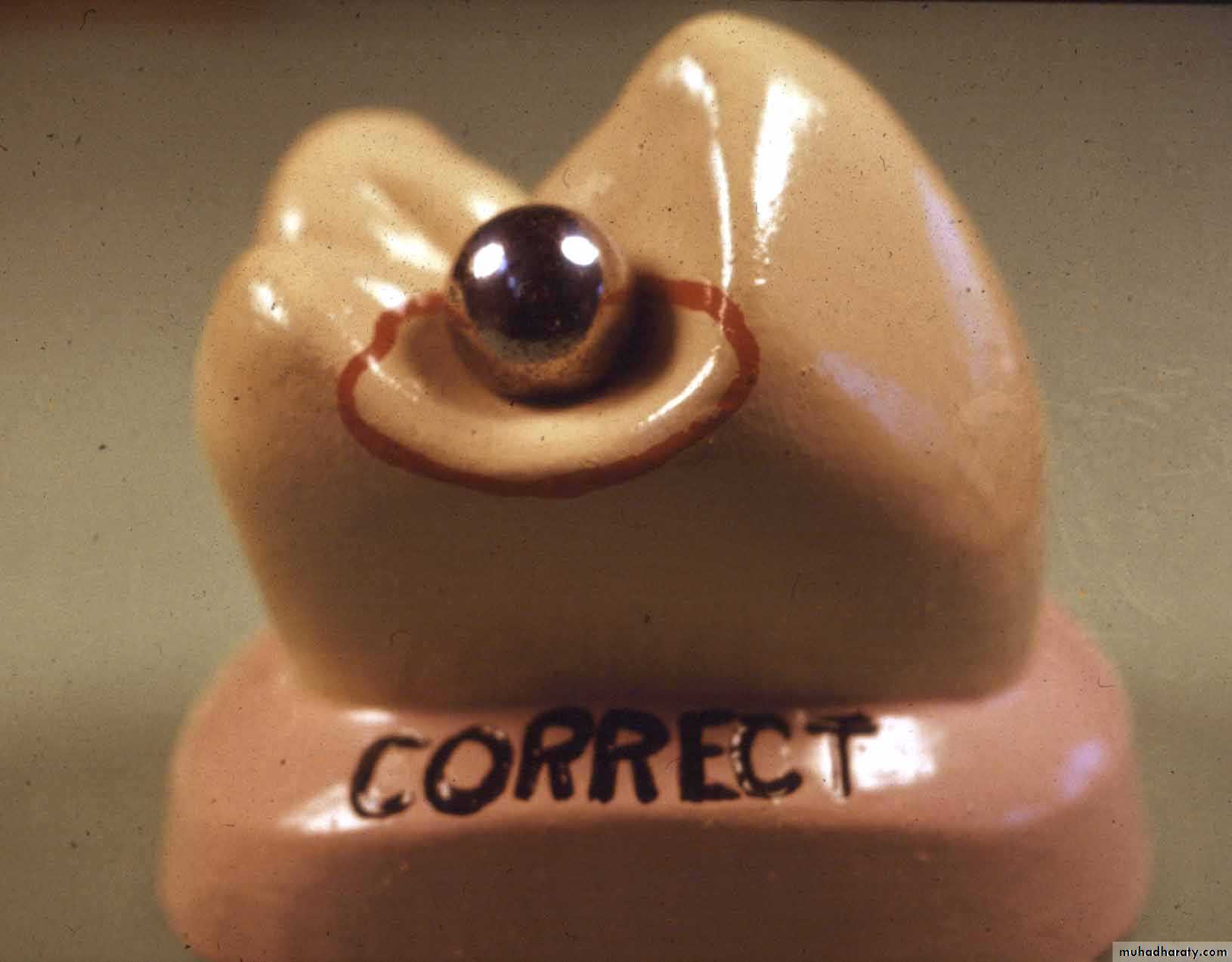 mouth preparation