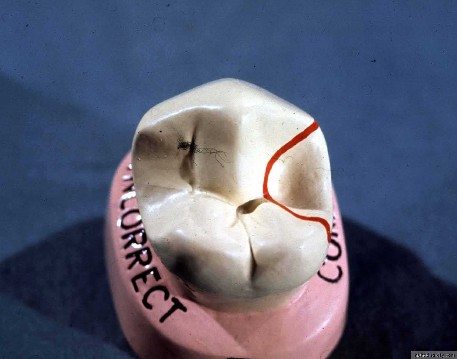 mouth preparation