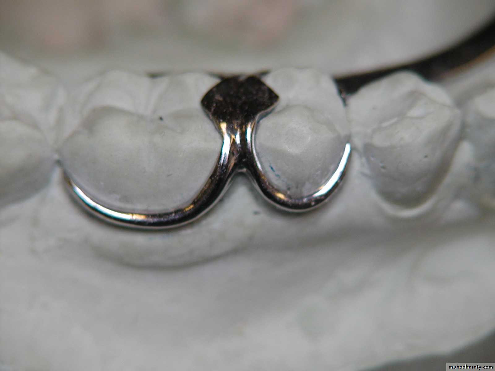 mouth preparation