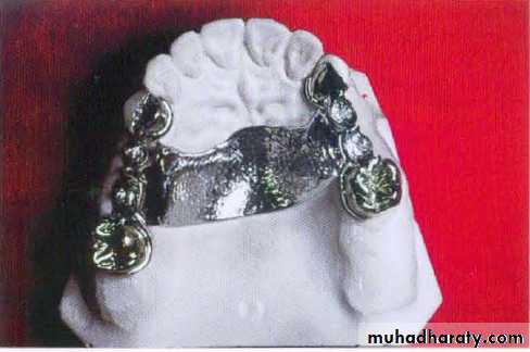 mouth preparation