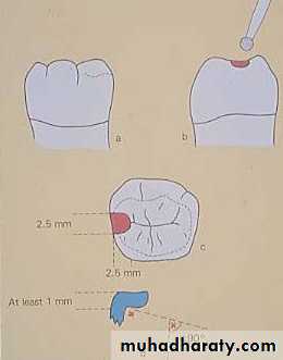 mouth preparation