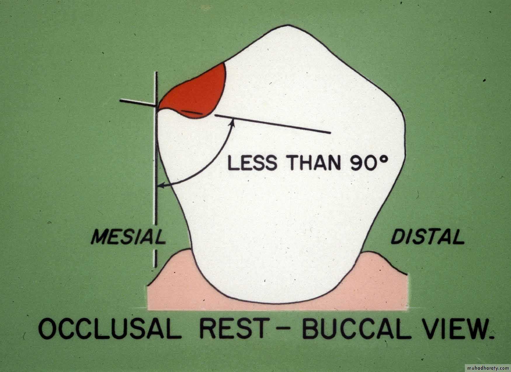 mouth preparation
