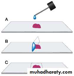 Preparation of Histological slides