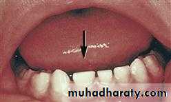 Development tooth disorders