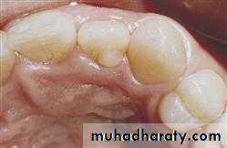 Development tooth disorders