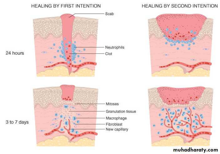 Tissue repair