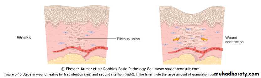 Tissue repair