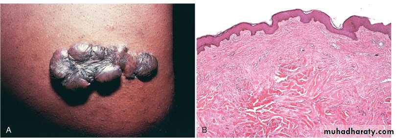 Tissue repair