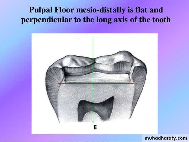 CL I Cavity_4