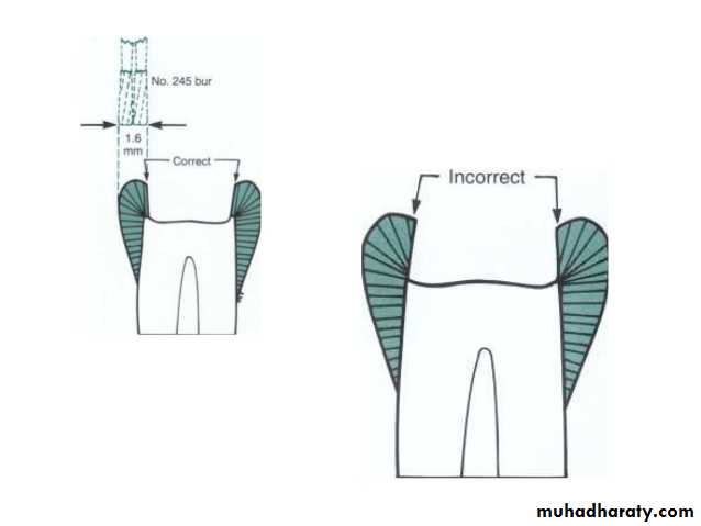 CL I Cavity_4