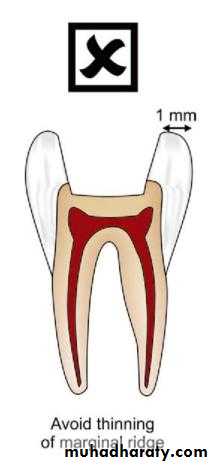 CL I Cavity_4