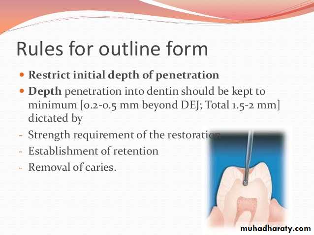 CL I Cavity_4