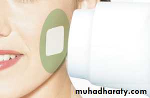 X-ray beam shape and position