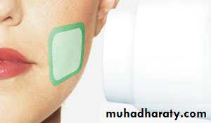 X-ray beam shape and position