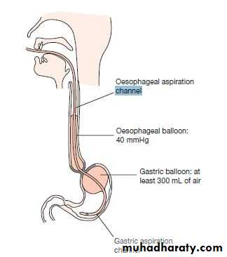 Upper GI bleeding