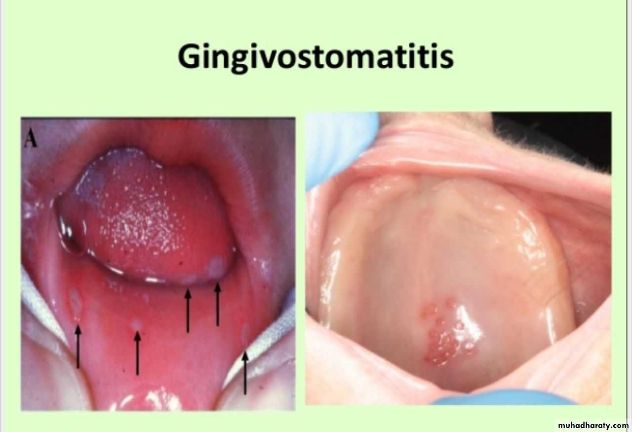 Herpesviruses