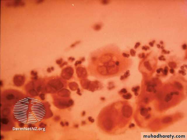 Herpesviruses