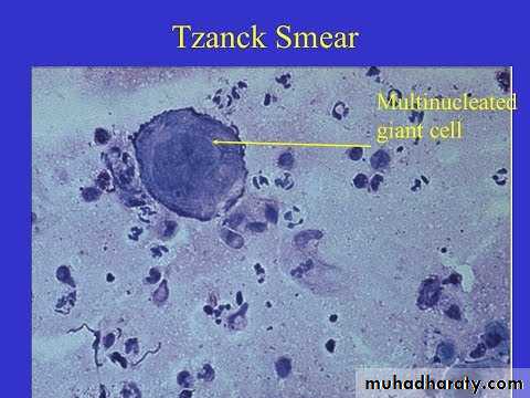 Herpesviruses