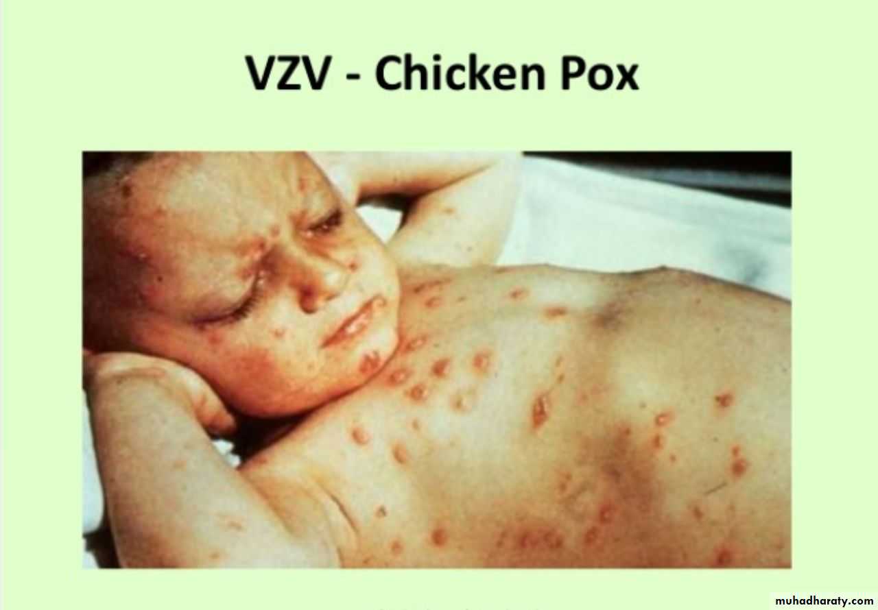 Herpesviruses