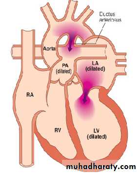 CHD
