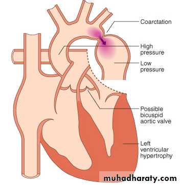 CHD