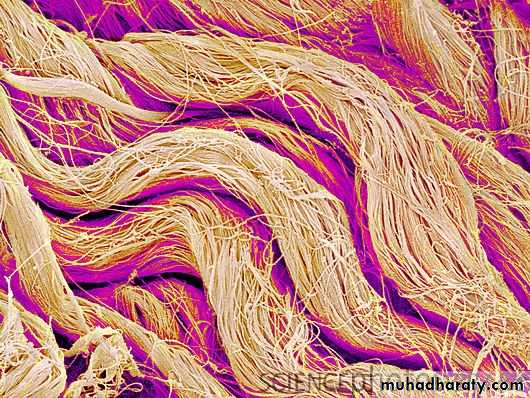 Connective tissue