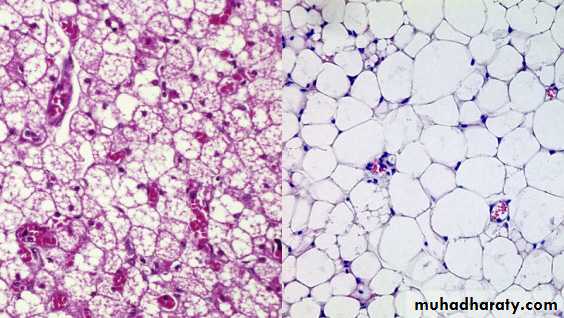 Connective tissue
