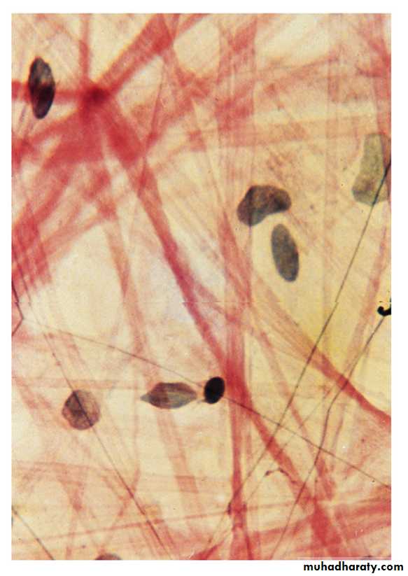 Connective tissue