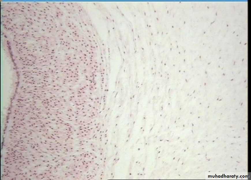 Connective tissue