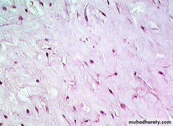 Connective tissue