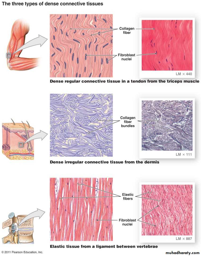 Connective tissue